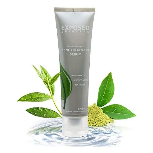 Exposed Skin Care Acne Treatment Serum Step 3 – Quickly Reduces Pimple Size and Redness - 12 Hour Spot Treatment - 3.5% Benzoyl Peroxide, Natural Green Tea & Tea Tree Oil