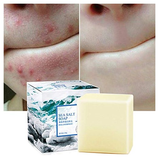 Soap with Sea Salt Natural Goat's Milk for Face Dry and Natural Oily Skin, Remove Acne Anti-cellulite Soap (3.52 Oz)