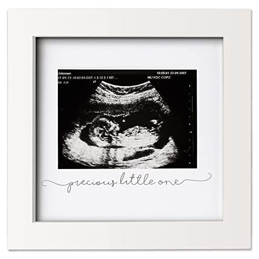 Baby Sonogram Picture Frame - Modern Ultrasound Frame For Mom To Be - Pregnancy Announcement Sonogram Photo Frames - Gender Reveal For Expecting Parents - First Time Dad Gifts (Alpine White)