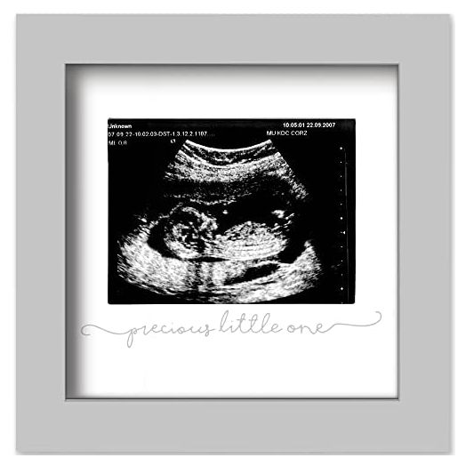 Baby Sonogram Picture Frame - Modern Ultrasound Frame For Mom To Be - Pregnancy Announcement Sonogram Photo Frames - Gender Reveal For Expecting Parents - First Time Dad Gifts (Cloud Gray)