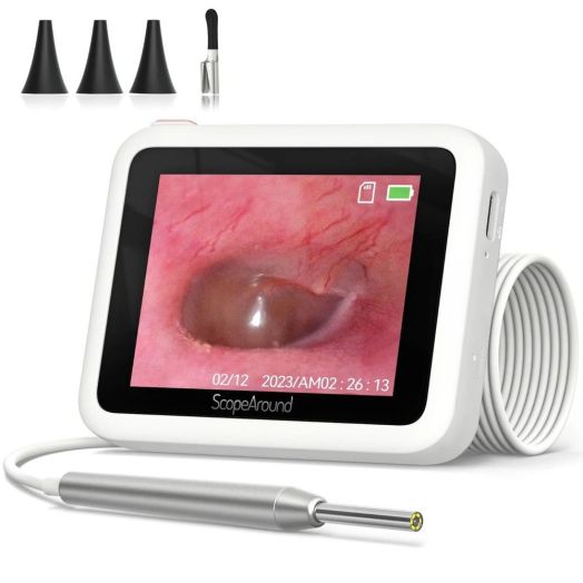 ScopeAround All-In-One Digital Otoscope, 2.8-Inch LCD Screen
